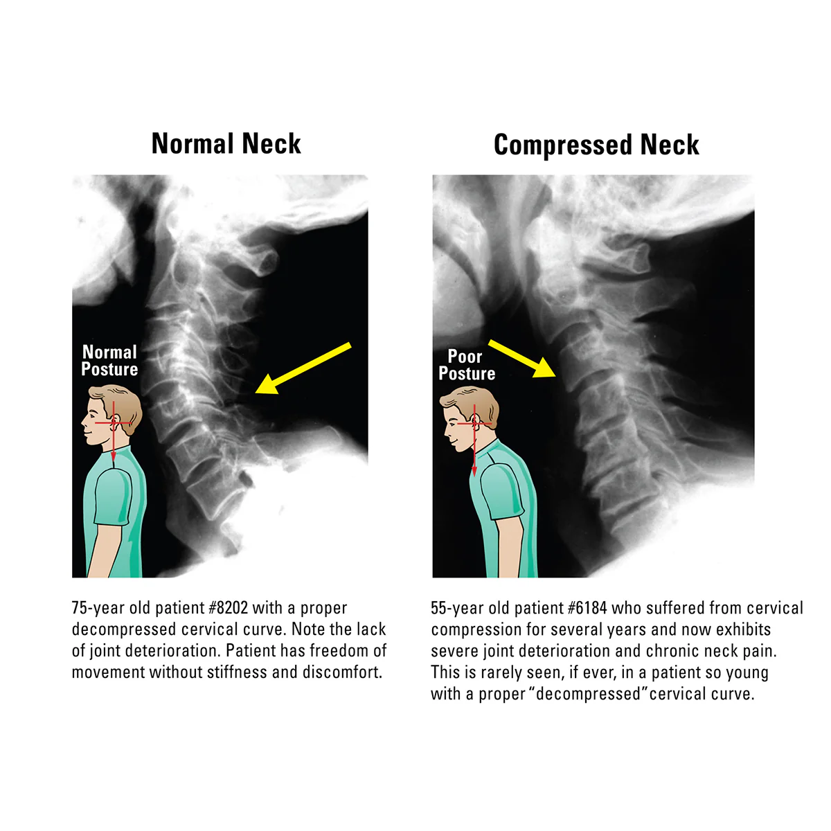 At Home Neck and Back Pain Reliever - Image 3
