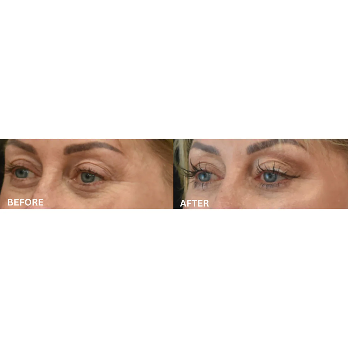 EMS & Heat Therapy Silicone Eye Mask - Image 6