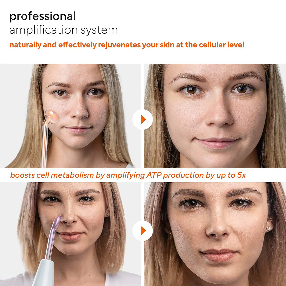 Professional Skin Rejuvenator - Image 2